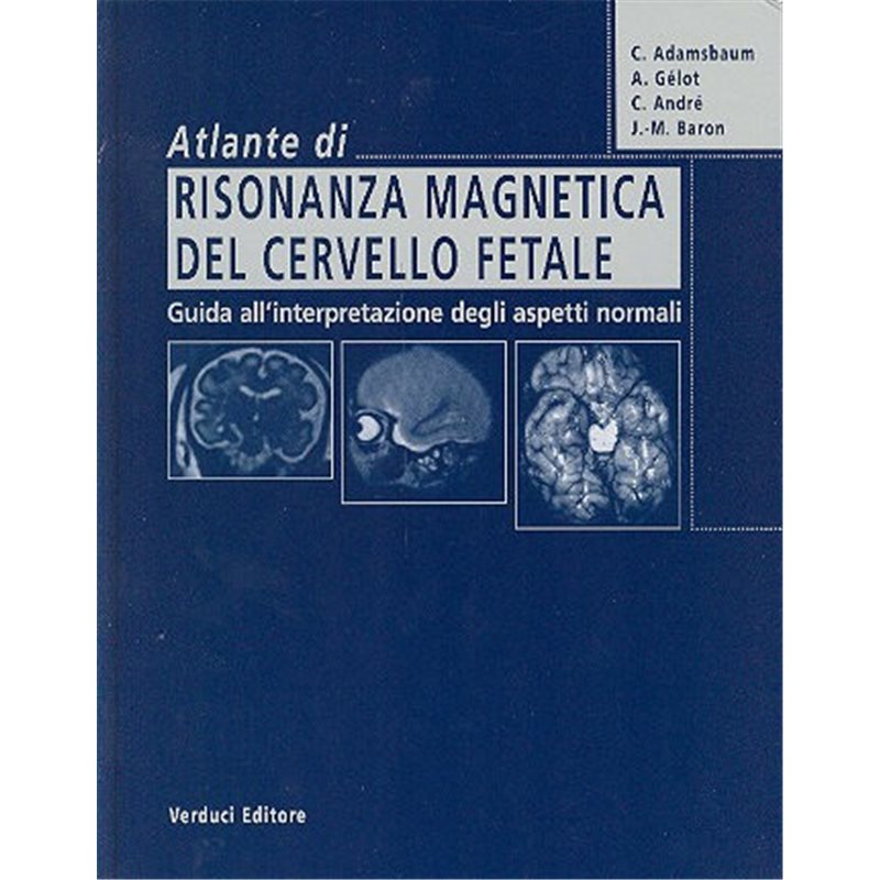 Atlante di RISONANZA MAGNETICA del CERVELLO FETALE